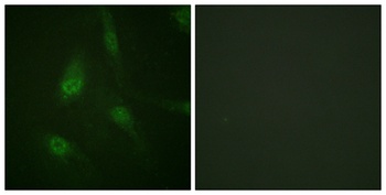 NFATc3 (phospho Ser165) rabbit pAb Antibody