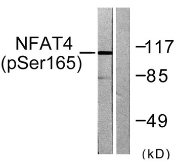 NFATc3 (phospho Ser165) rabbit pAb Antibody