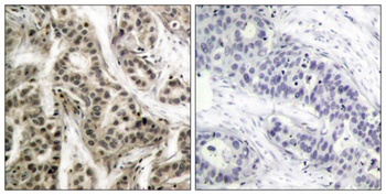 NFκB-p105/p50 (phospho Ser337) rabbit pAb Antibody