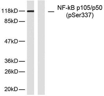 NFκB-p105/p50 (phospho Ser337) rabbit pAb Antibody