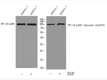 NFκB-p100 (phospho Ser872) rabbit pAb Antibody