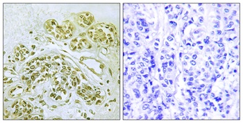 IκB-α (phospho Tyr42) rabbit pAb Antibody