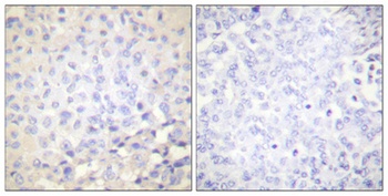 IκB-ε (phospho Ser22) rabbit pAb Antibody
