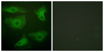 IκB-ε (phospho Ser22) rabbit pAb Antibody