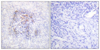 IRP-1 (phospho Ser138) rabbit pAb Antibody