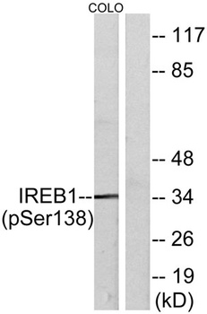 IRP-1 (phospho Ser138) rabbit pAb Antibody
