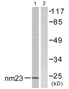 NM23-H2 rabbit pAb Antibody