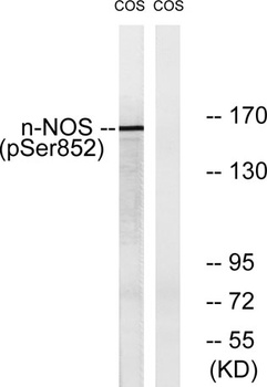 NOS1 (phospho Ser852) rabbit pAb Antibody