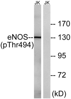eNOS (phospho Thr494) rabbit pAb Antibody