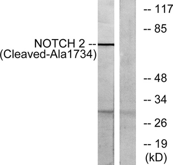 Cleaved-Notch 2 (A1734) rabbit pAb Antibody
