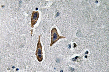 Nephrin rabbit pAb Antibody