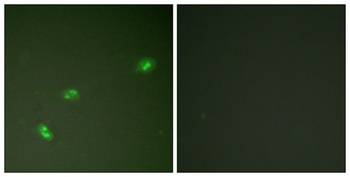 B23 (phospho Thr199) rabbit pAb Antibody