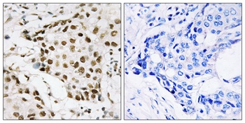 B23 (phospho Thr199) rabbit pAb Antibody