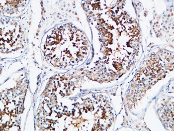 YB-1 rabbit pAb Antibody