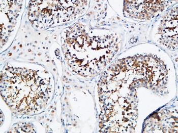 YB-1 rabbit pAb Antibody