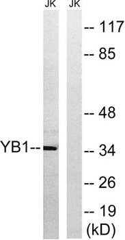 YB-1 rabbit pAb Antibody