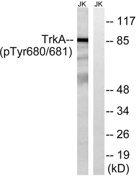 Trk A (phospho Tyr680/Y681) rabbit pAb Antibody