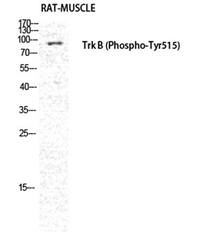 Trk B (phospho Tyr516) rabbit pAb Antibody
