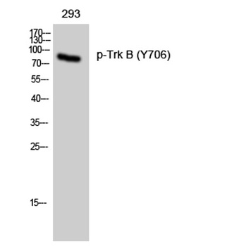 Trk B (phospho Tyr706) rabbit pAb Antibody
