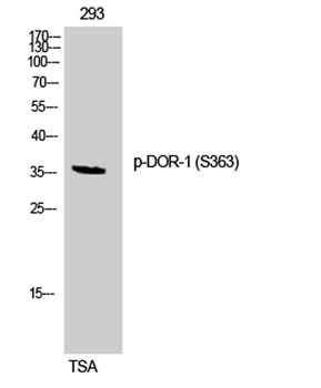 DOR-1 (phospho Ser363) rabbit pAb Antibody