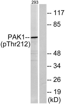 PAKα (phospho Thr212) rabbit pAb Antibody