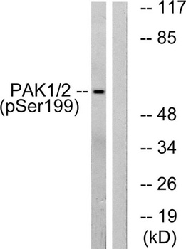 PAKα (phospho Ser199) rabbit pAb Antibody