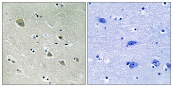 PAKα (phospho Ser204) rabbit pAb Antibody