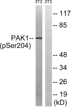 PAKα (phospho Ser204) rabbit pAb Antibody