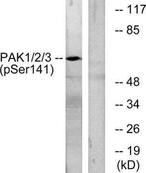 PAKα/β/γ (phospho Ser144/141/139) rabbit pAb Antibody