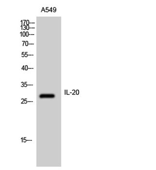 IL-20 rabbit pAb Antibody