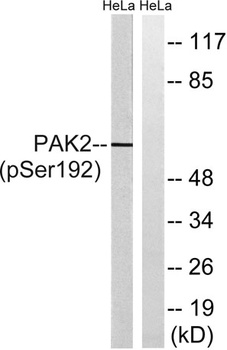 PAKγ (phospho Ser192) rabbit pAb Antibody