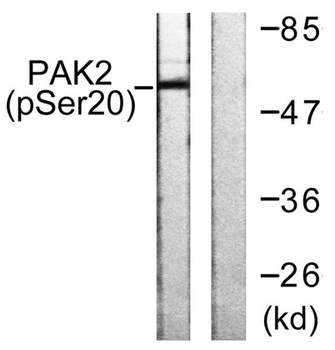 PAKγ (phospho Ser20) rabbit pAb Antibody
