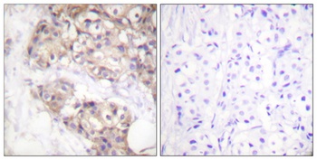 PAKγ rabbit pAb Antibody