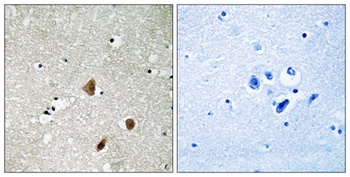 PAKβ (phospho Ser154) rabbit pAb Antibody