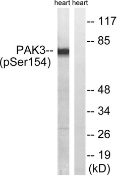 PAKβ (phospho Ser154) rabbit pAb Antibody