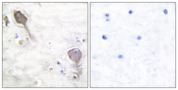PARK2 rabbit pAb Antibody