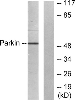 PARK2 rabbit pAb Antibody