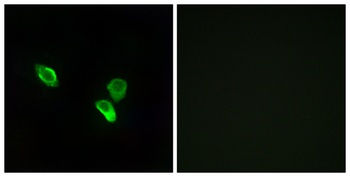 MRP-S18C rabbit pAb Antibody