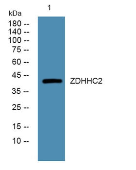 ZDHHC2 rabbit pAb Antibody