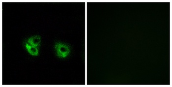 MARCH2 rabbit pAb Antibody