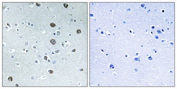 MARCH2 rabbit pAb Antibody