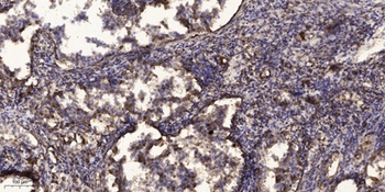 PIPOX rabbit pAb Antibody