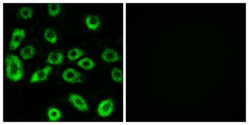 ATP5D rabbit pAb Antibody