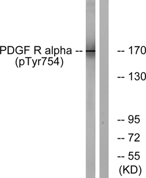 PDGFR-α (phospho Tyr754) rabbit pAb Antibody