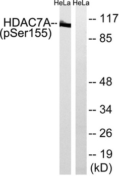 HDAC7 (phospho Ser155) rabbit pAb Antibody