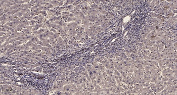 PDGFR-β (phospho Tyr771) rabbit pAb