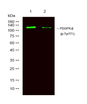 PDGFR-β (phospho Tyr771) rabbit pAb