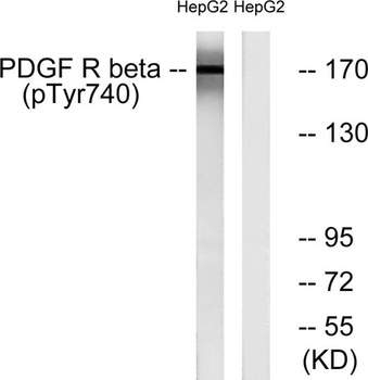 PDGFR-β (phospho Tyr740) rabbit pAb