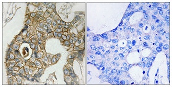 PDGFR-β (phospho Tyr751) rabbit pAb