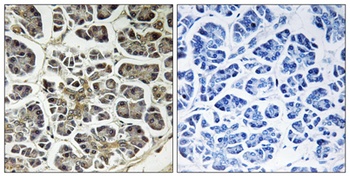 ATP5G2 rabbit pAb Antibody